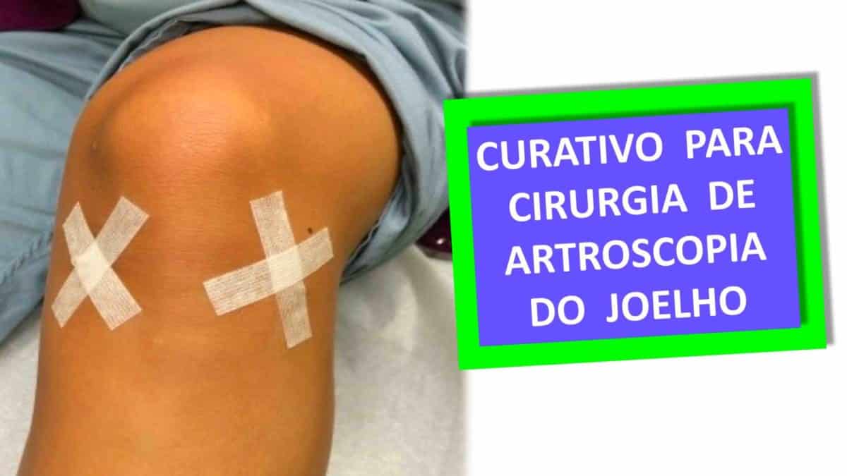 Curativo para Cirurgia no Joelho – Artroscopia - Clínica do Joelho