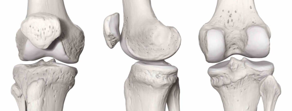 Ossos Do Joelho Clínica Do Joelho